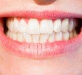 Zobni aparat nam predpiše naš zobozdravnik