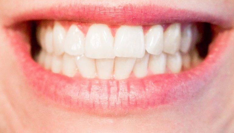 Zobni aparat nam predpiše naš zobozdravnik